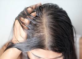 Thin Hair