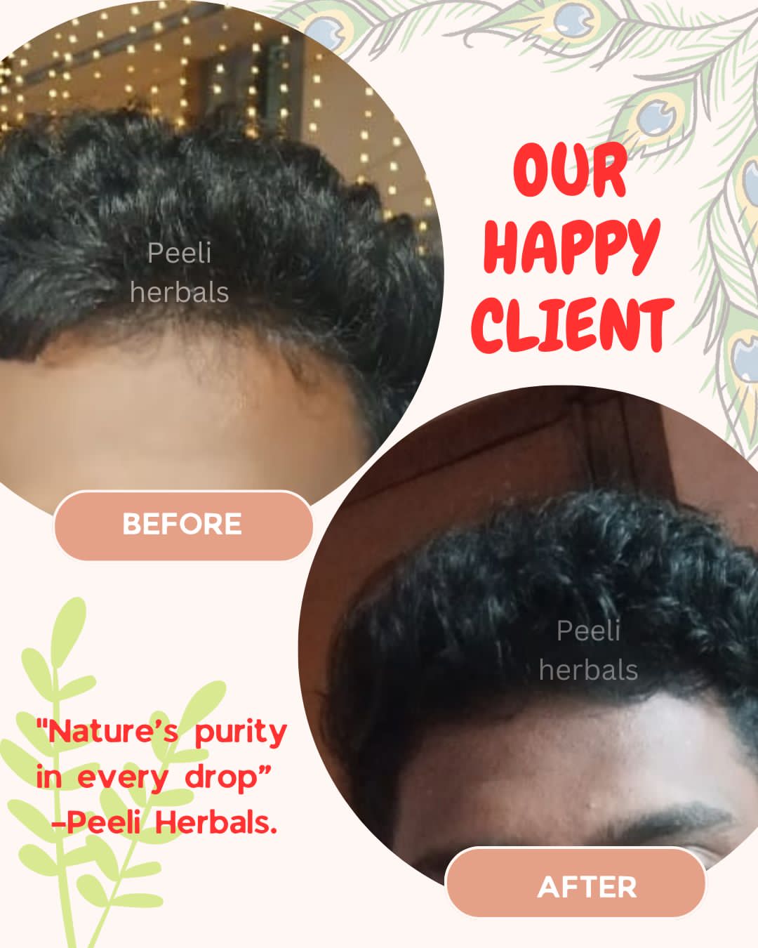 Customer 1